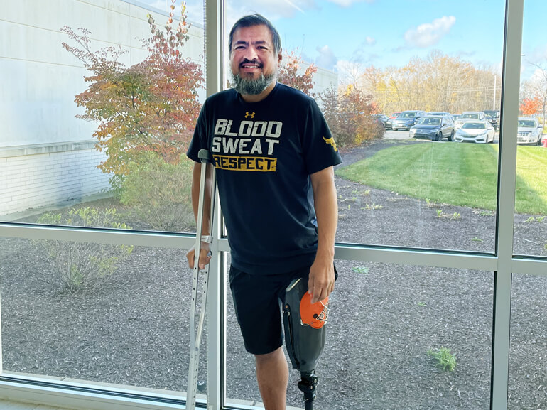 Freddie Martinez stands in front of a window using his crutch to balance while wearing his prosthetic left leg.