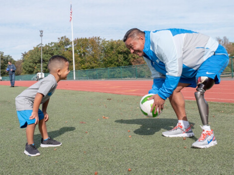 Patient with amuptated leg playing soccer with his son.