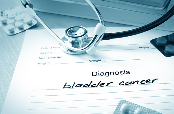 Close up of a stethoscope and a paper that says "Diagnosis: bladder cancer"